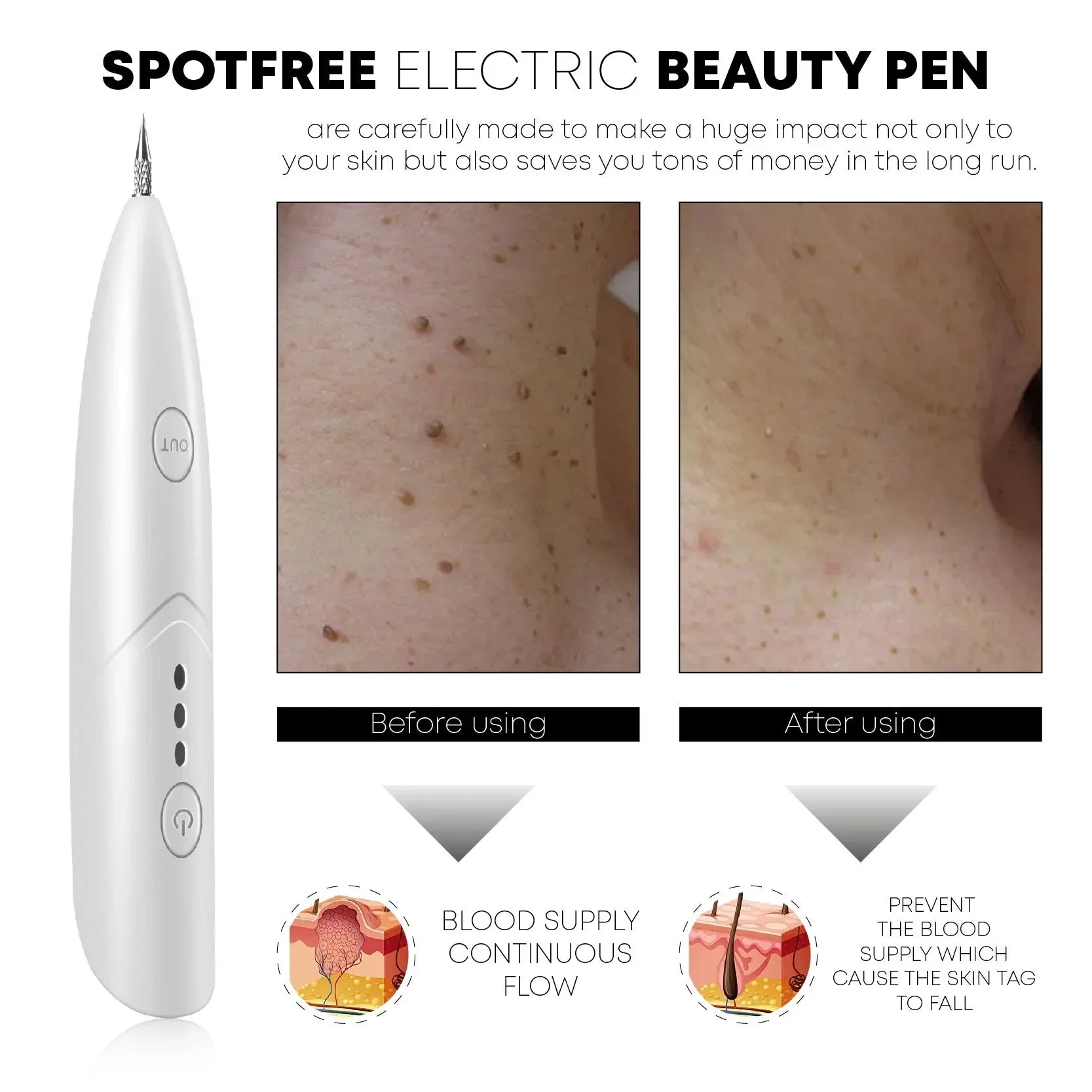 SpotRemoval Beauty Electric Pen